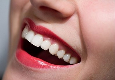 cách làm trắng răng đơn giản lại hiệu quả